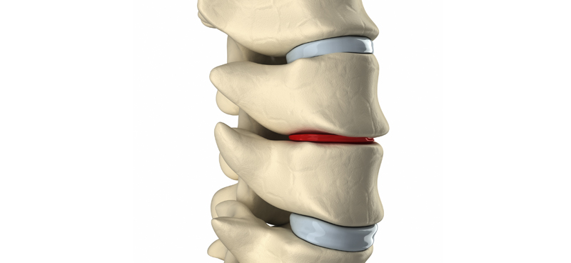 Houston Pain Centers is now US Pain and Spine | Houston Spine Center